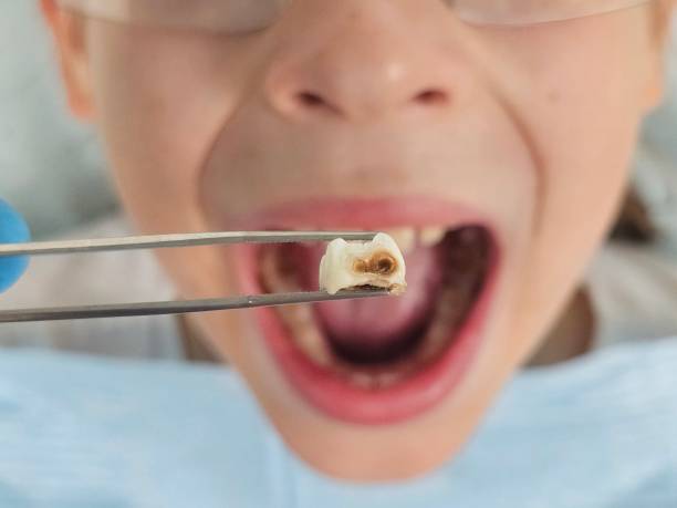 Best Walk-In Emergency Dentist in Wayne, MI